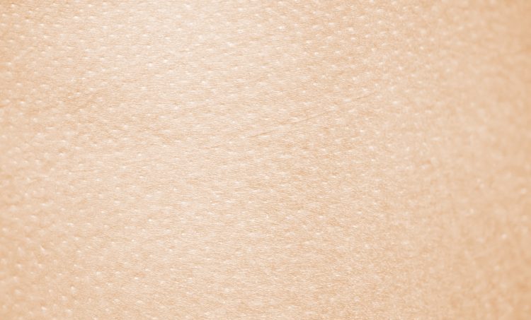 Atopisch eczeem, het signaal van een verstoorde huidbarrière