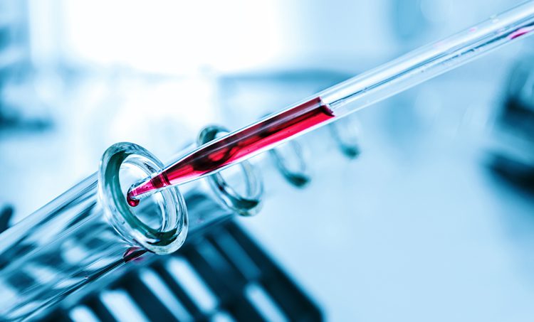 Primaire hemochromatose (HFE-hemochromatose)